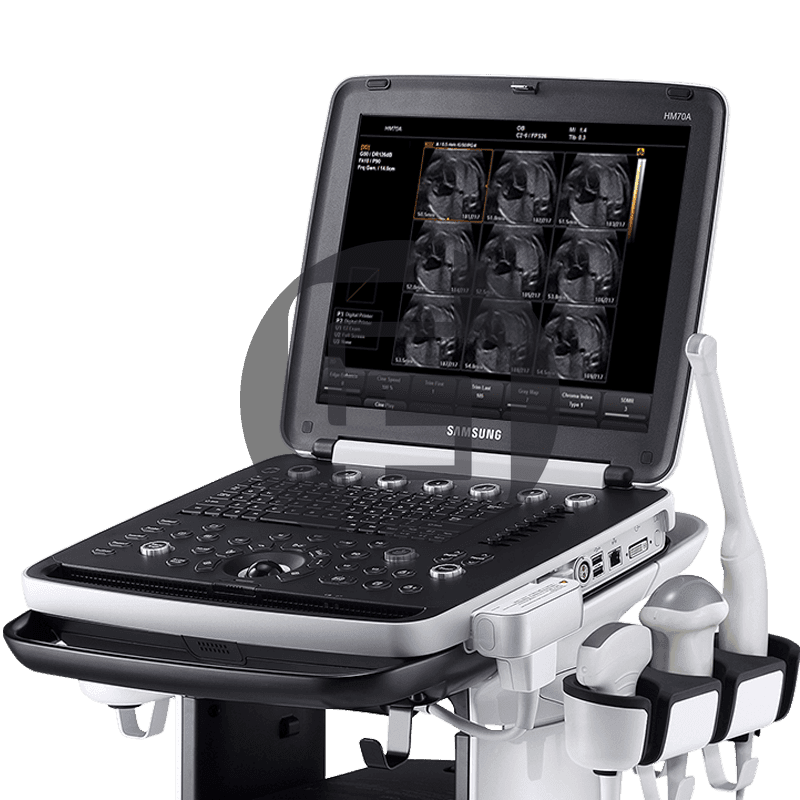 Портативный УЗИ сканер Samsung HM70a