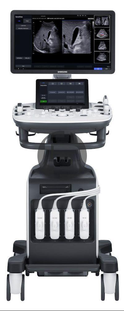 УЗИ аппарат Samsung HS60