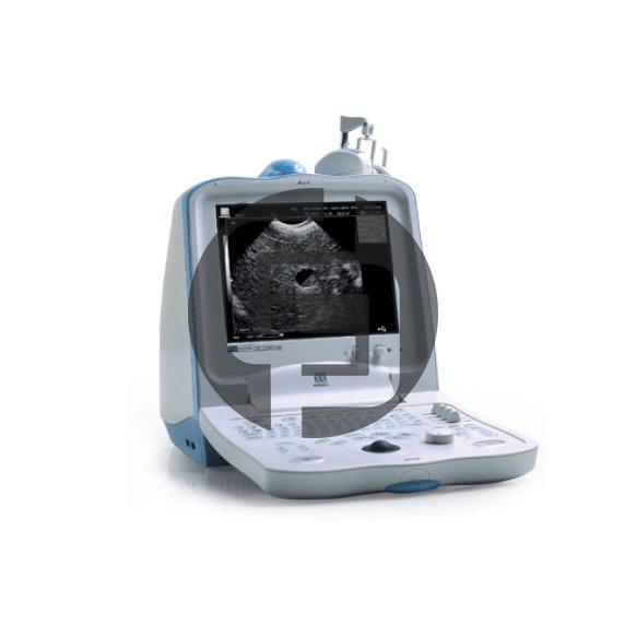УЗИ аппарат Mindray DP 3300