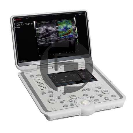 УЗИ аппарат Esaote MyLab Omega