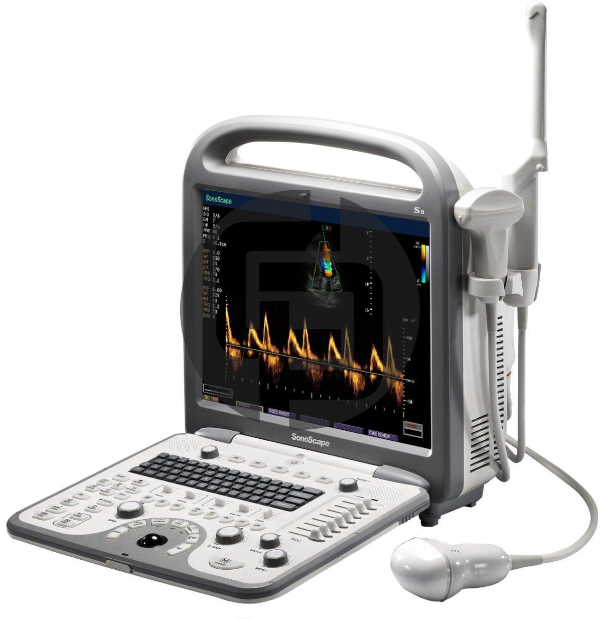 Ультразвуковой сканер SonoScape S8