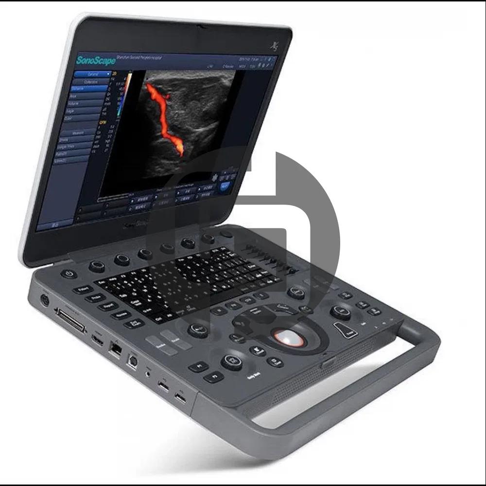 УЗИ аппарат SonoScape X5