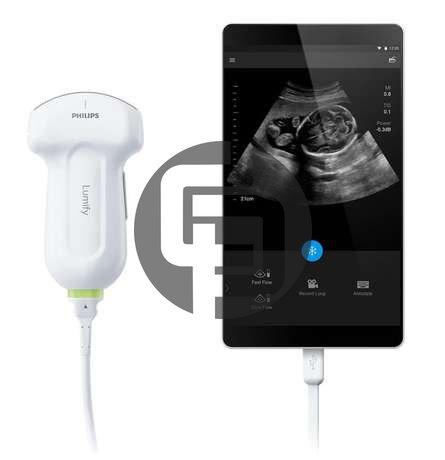 Мобильная ультразвуковая система Philips Lumify