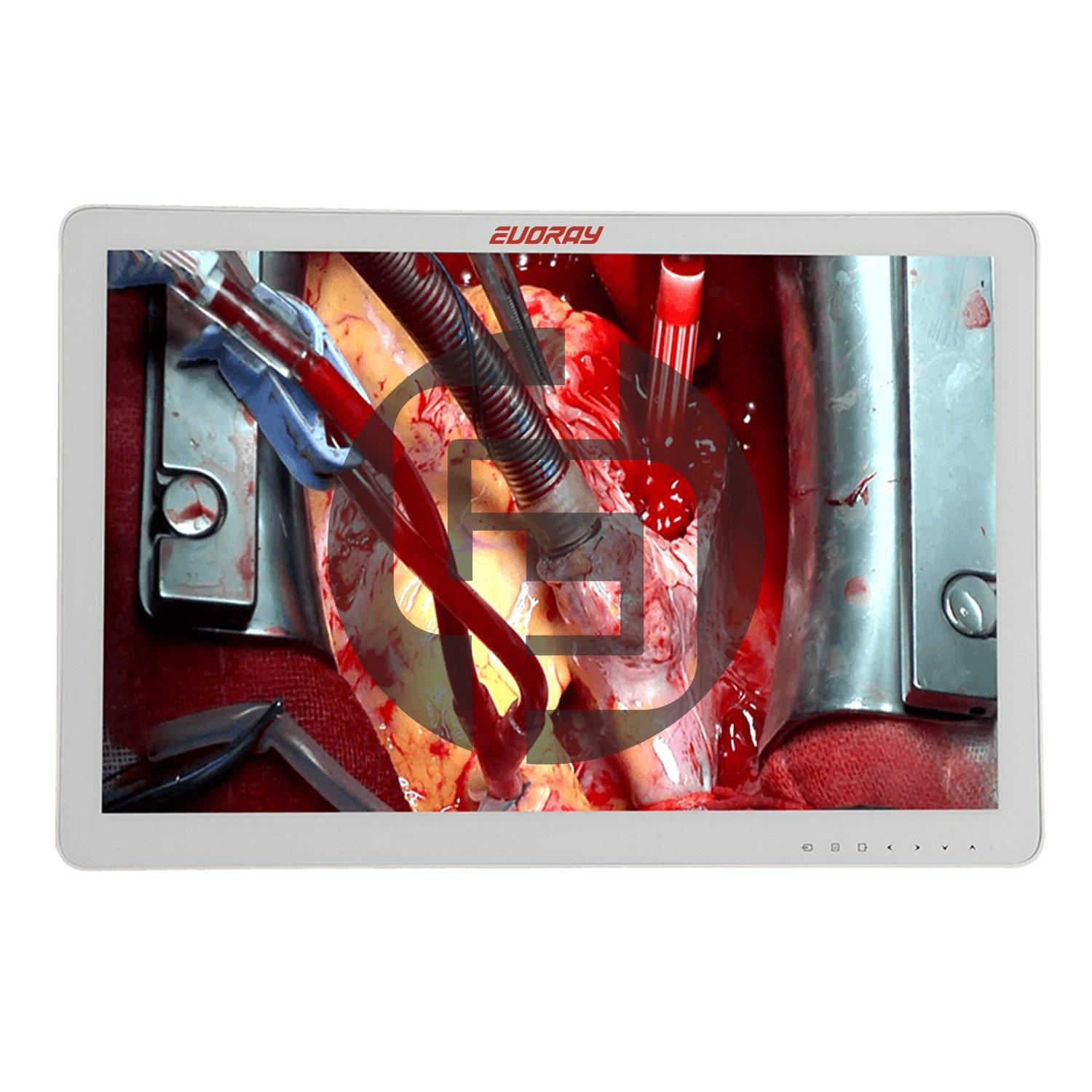 Монитор 32" Full HD эндоскопический-хирургический EVORAY S3221P