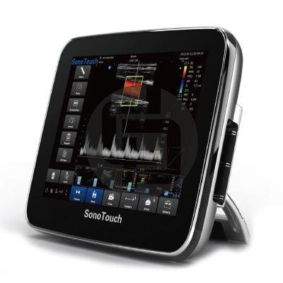 УЗИ аппарат CHISON SonoTouch 30 (ECO 3)