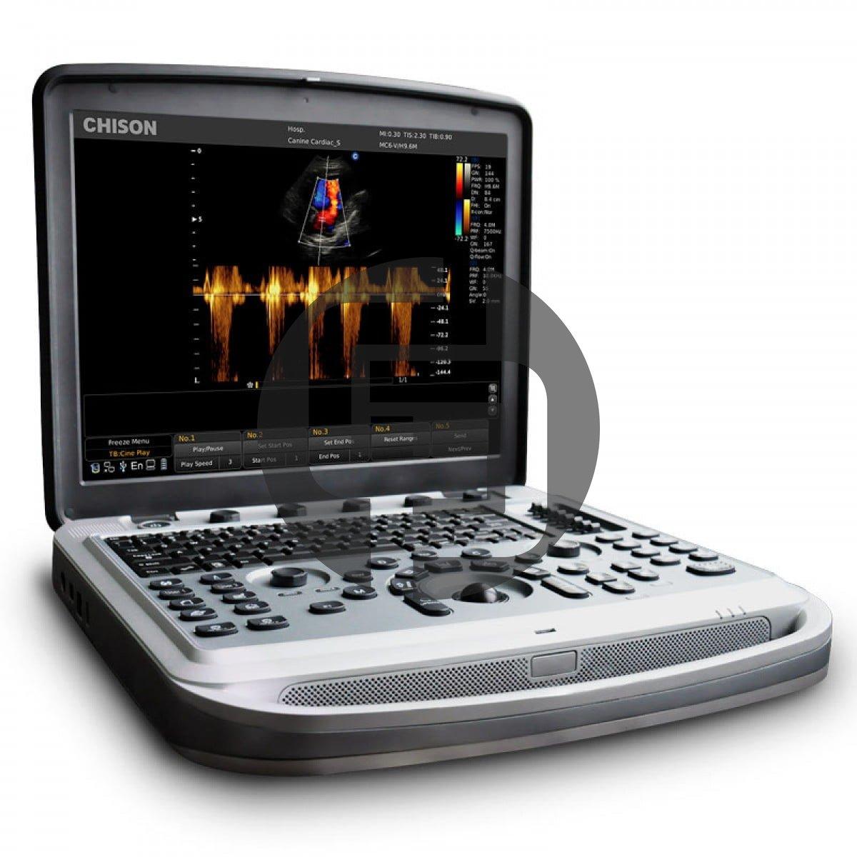 УЗИ аппарат Chison SonoTouch 80 (SonoBook 8)