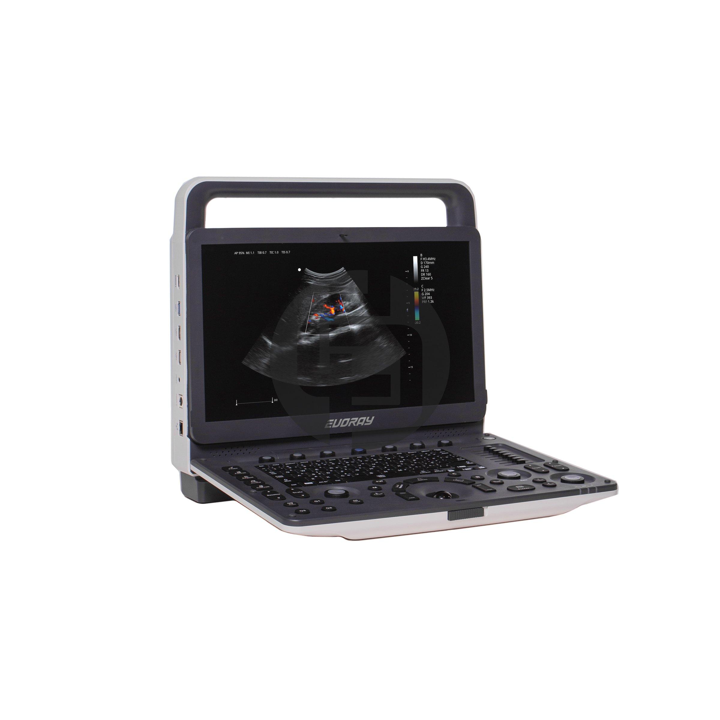 Портативный УЗИ аппарат EVORAY USP 30
