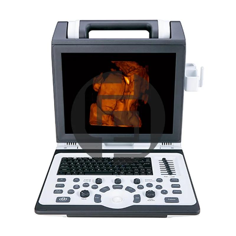 Портативный ультразвуковой сканер SIUI CTS 7700 2 датчика