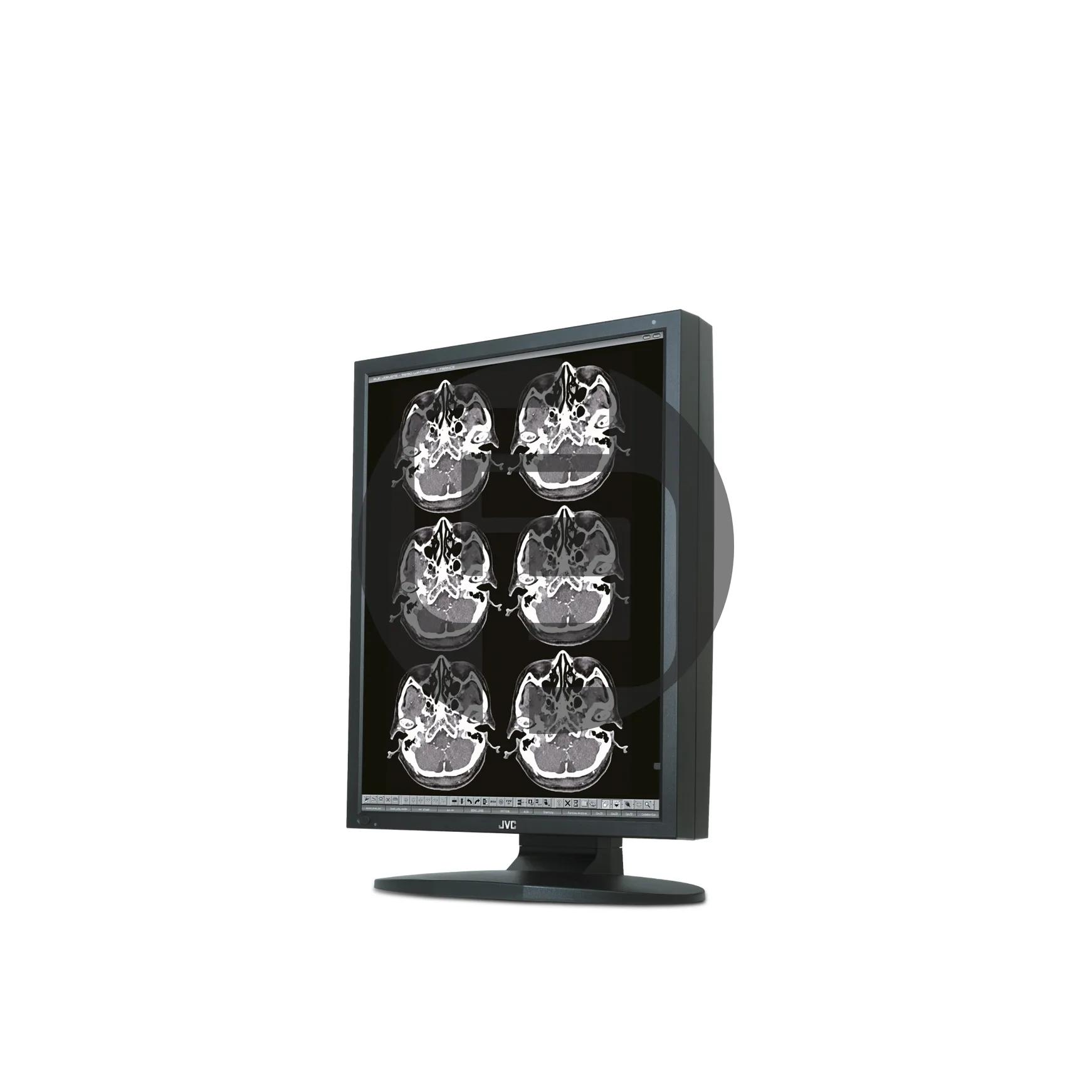 Медицинский монитор JVC MS25i2