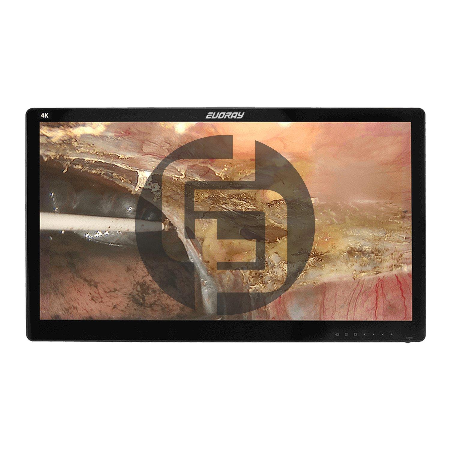Монитор 32" 4K эндоскопический-хирургический EVORAY S3281P