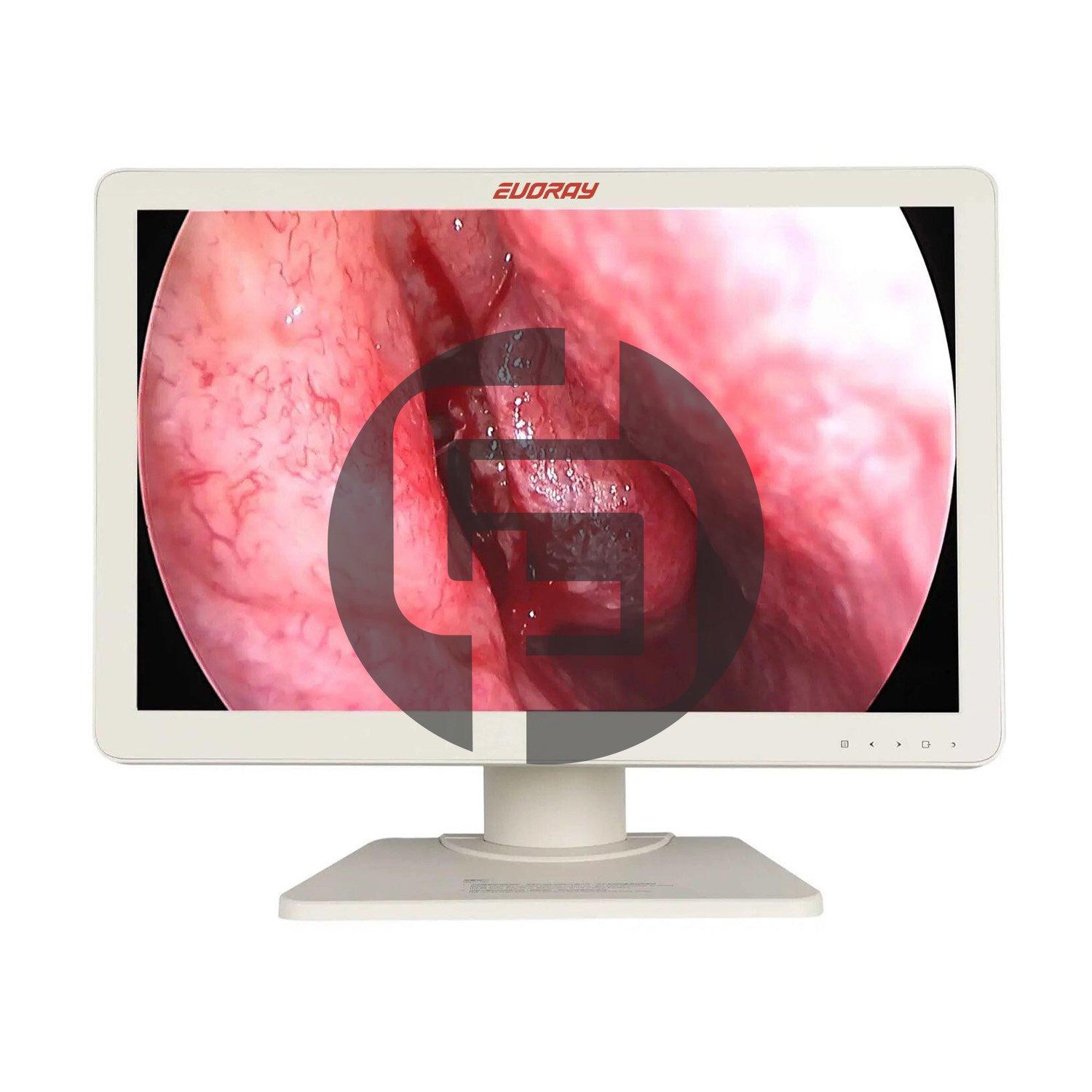 Монитор 27” Full HD эндоскопический-хирургический EVORAY S271P