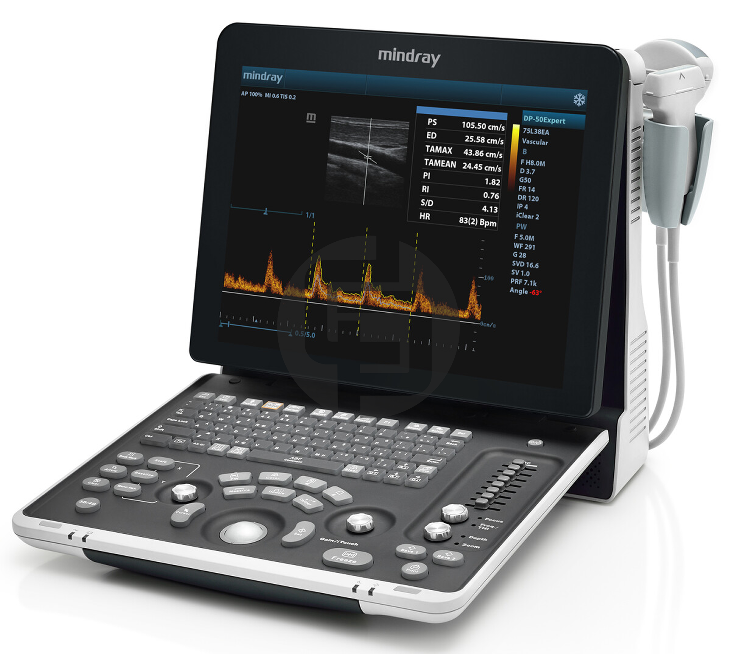 УЗИ сканер Mindray Z60