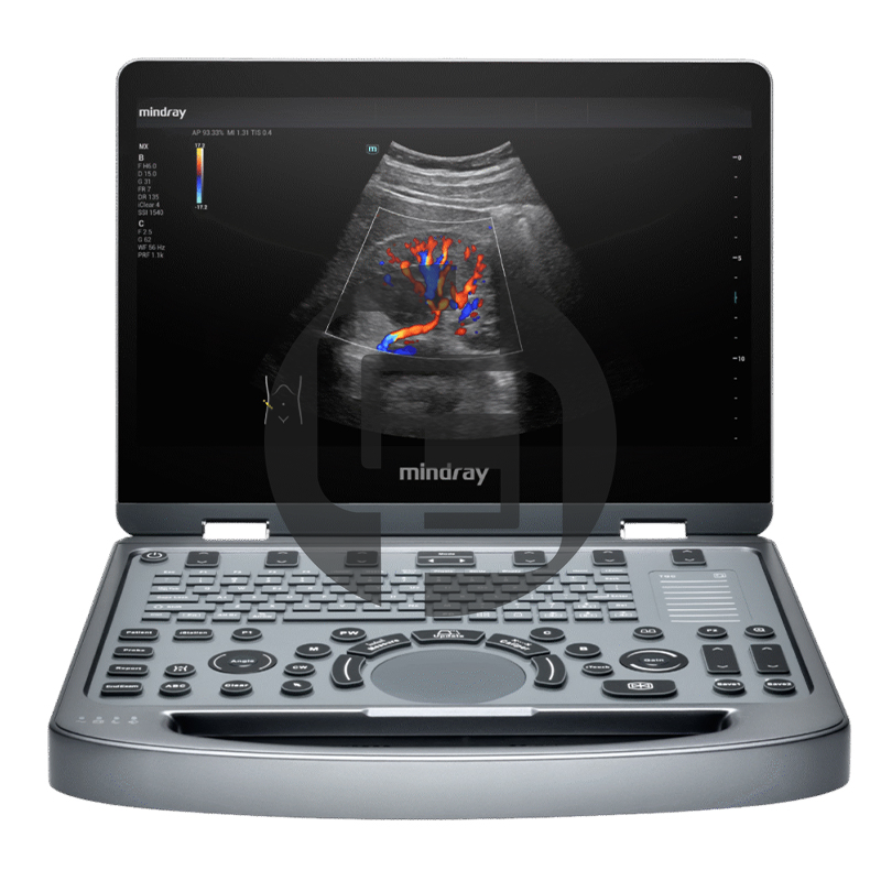 УЗИ аппарат Mindray MX3