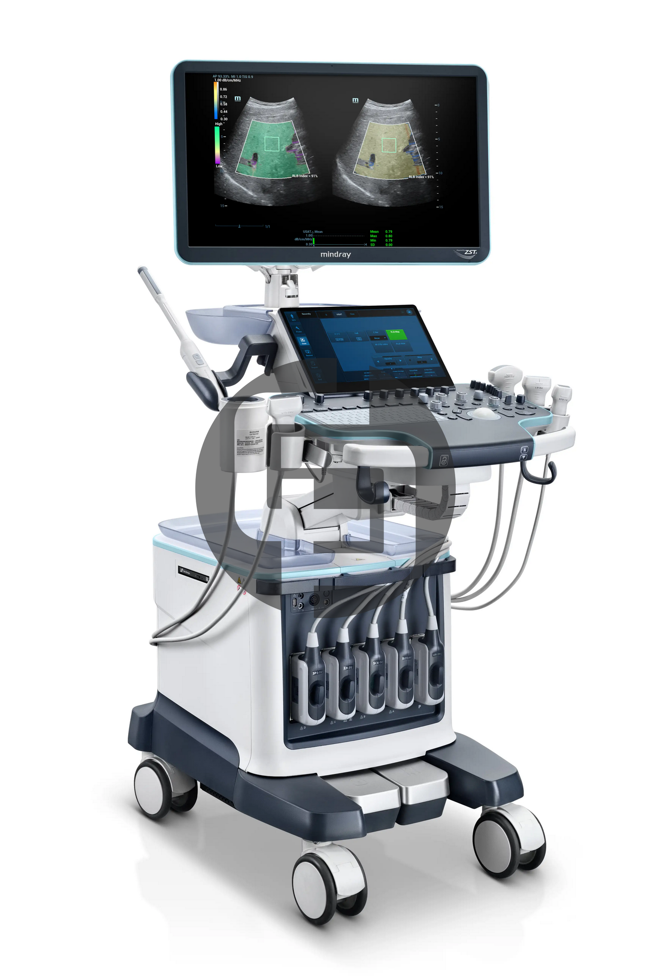 УЗИ аппарат Mindray Recho R9