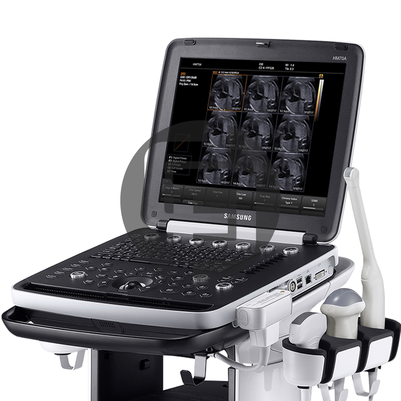 Портативный УЗИ сканер Samsung HM70a