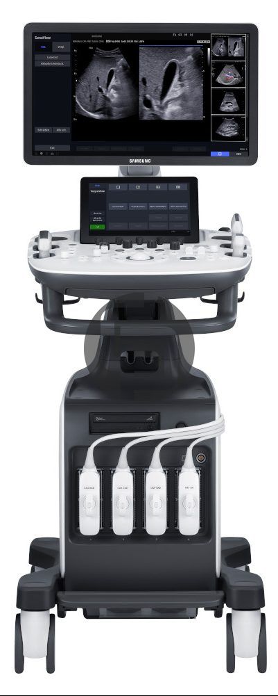 УЗИ аппарат Samsung HS60